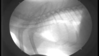 Primary Tracheal Collapse7DAY460Fluoroscopy [upl. by Needan76]