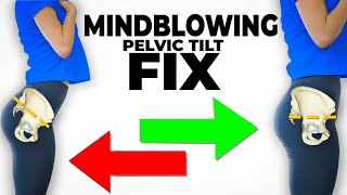 The Mindblowing Best Fix For Anterior Pelvic Tilt instant results [upl. by Gerek127]