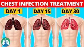 7 Natural Chest Infection Treatments Home Remedies [upl. by Asillim578]