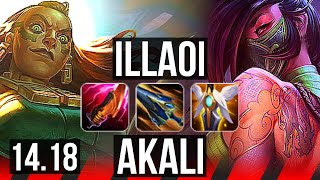 ILLAOI vs AKALI TOP  66 winrate Dominating  EUW Master  1418 [upl. by Donegan]