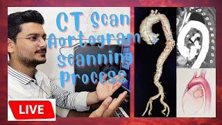 live CT Scan Aortogram scanning process and techniques  scanning process of Aortic Angiography [upl. by Filomena]