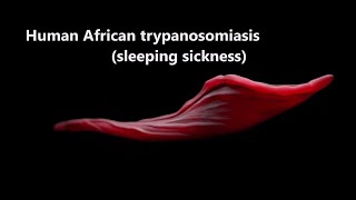 Human African Trypanosomiasis sleepingsickness Trypanosomiasis WHO [upl. by Aehs]