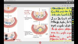 Damar patolojisi 1 patoloji [upl. by Eitsrik41]