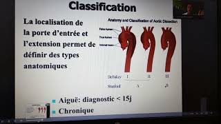 Dissection Aortique  Classification [upl. by Boorer]