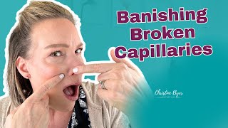 How to Get Rid of Broken Capillaries on the Face [upl. by Lauralee]