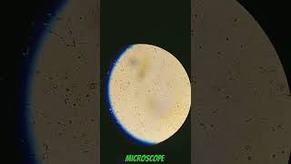 see tha sperm microscope lab technician student🔬shorts video reel like and share video [upl. by Lorrac]