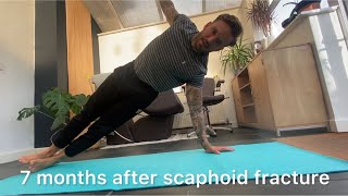 7 months after scaphoid fracture recovery update exercises progress [upl. by Marcos]