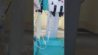 Plasmapheresis TPE Manoj Palackel 24 [upl. by Ahsiekim]