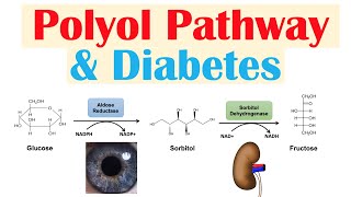 Polyol Pathway amp Diabetes  The Role of Polyol Pathway in Diabetes Pathogenesis [upl. by Lamoree657]