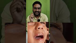 Veribond injection uses  Full Video in Bio dolo kimshospital food silkfibroin multibond [upl. by Peggir]