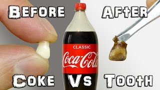 What Does It Do  Coke Vs Teeth Experiment [upl. by Chaddy312]