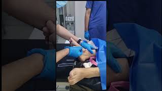 IV canullation how to insert intravenous canulla to vein [upl. by Renat]