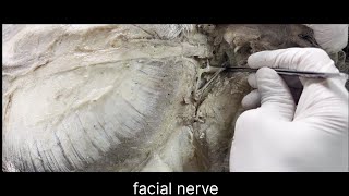 Facial nerve anatomy [upl. by Odnomor957]