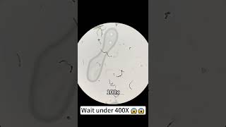 Pepsi at 400X magnification is really cool underthemicroscope beefcut scienceshorts [upl. by Anahoj]