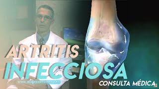 ¿Qué es la artritis infecciosa  Síntomas y Tratamiento [upl. by Lekzehcey]