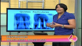 Odontologia  Quistes dentales beningnos Parte 1 [upl. by Fin]