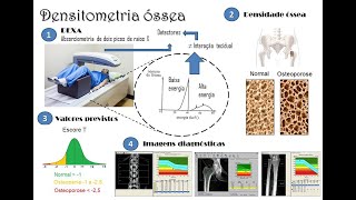 Densitometria óssea  Tópicos gerais [upl. by Patience]