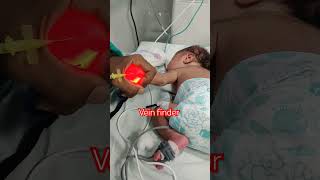 vein finder vain iv cannula insertion New born baby boy bornebaby viral reels nicu babyboy [upl. by Donaldson]