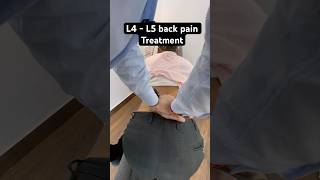 L4  L5 back pain treatment by dr harish grover [upl. by Aroel]