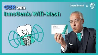 The surgery of Digital implant solution and GBR using nonresorbable membrane WiFiMesh [upl. by Enneicul]