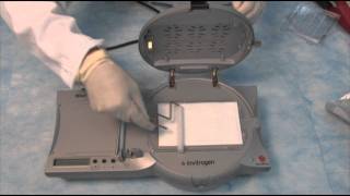 How to set up a Western part 3  The Blot Transfer using the iBlot® [upl. by Linnette599]