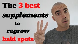 The 3 supplements you NEED on the AIP Elimination Diet to regrow bald spots [upl. by Narod]