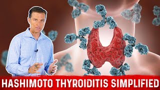 Hashimoto Thyroiditis Autoimmune Hypothyroid Simplified by Dr Berg [upl. by Jenkel]