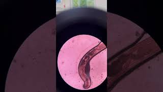 Enterobius vermicularis medtech parasite microscopy [upl. by Althee970]