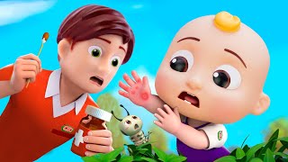 Ouchie Ouch Song  Newborn Got a BooBoo  Nursery Rhymes amp Kids Songs [upl. by Tan321]