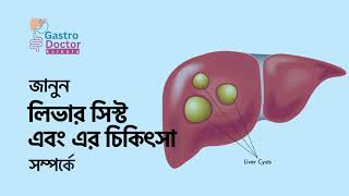 Liver Cyst and its Treatment Bengali  Dr Udipta Ray  Gastro Doctor Kolkata [upl. by Rikahs]