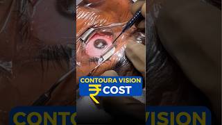 Contoura Vision Cost [upl. by Hamachi88]