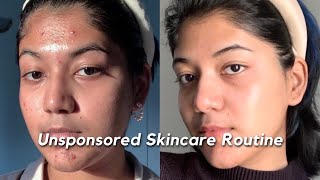 How I got rid of my ACNE SCARS amp TEXTURE  My Unsponsored Skincare Routine 🧴🫧🧖 [upl. by Hareehahs]