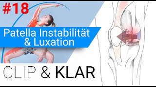 Patella Instabilität amp Luxation erklärt  Kniescheibe auf Abwegen [upl. by Anihpled791]