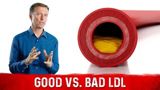 You Have Good and Bad LDL lowdensity lipoprotein [upl. by Ennovehc]