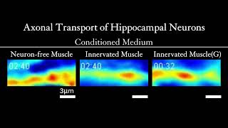 Axonal Transport of Hippocampal Neurons [upl. by English]