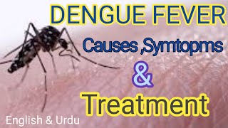 Dengue Fever  Causes  Symtopms amp Treatment  English amp Urdu language [upl. by Hawley]