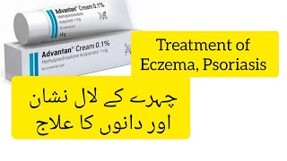 Advantan cream Advantan cream uses Advantan cream benefits in urdu Skin Inflammation ka Ilaaj [upl. by Sachs]