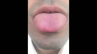 Tongue Fasciculation or something else [upl. by Aicenet189]