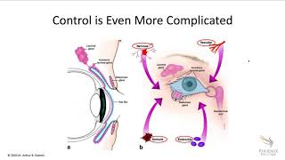 Online Seminar Art Epstein Dry Eye A Simple Approach to InDepth Understanding [upl. by Freberg]