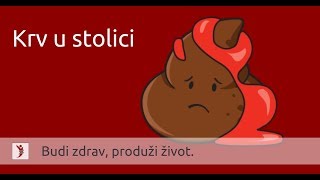 Krv u stolici [upl. by Akym]