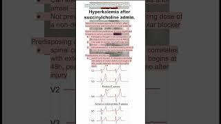 Hyperkalemia after succinylcholine admin [upl. by Foy]