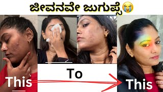 ಹಾಳಾಗಿದ್ದ skin ಅನ್ನು ಹೇಗೆ ಸರಿಪಡಿಸಿಕೊಂಡೆ  Skin care journey Kannada Vlogs [upl. by Gianni]