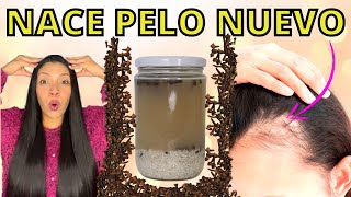 EL CABELLO CRECE COMO LOCO Y NO SE CAE😱 LA MEJOR RECETA DEL MUNDO PARA CRECER PELO😍FORMULA POTENTE [upl. by Wartow]