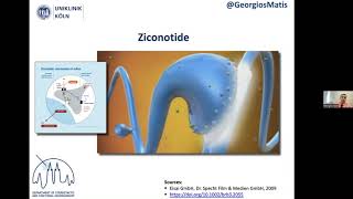 Dr Georgios Matis  Neuromodulation  Intrathecal therapy  Ziconotide [upl. by Ladew]