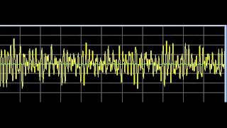 Infections  Rife Frequencies [upl. by Solorac660]