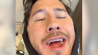 I GOT MY WISDOM TEETH REMOVED [upl. by Yrrej]