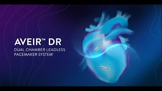 AVEIR DR™ Dual Chamber Leadless Pacemaker System 3D Implantation Simulation [upl. by Eeliab]