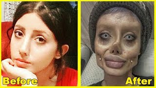 Sahar Tabar  Before amp After Plastic Surgery  Corpse Bride [upl. by Orrocos66]