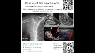 Case 46 A Scapular Enigma [upl. by Hervey]