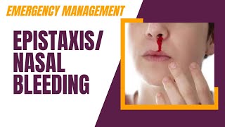 Emergency Management of Epistaxis  Nasal Bleeding Bleed through Nose [upl. by Holcman612]